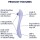 Satisfyer Easy Lover Klitoris-Saugstimulator mit Vibrationsfunktion Wasserdicht